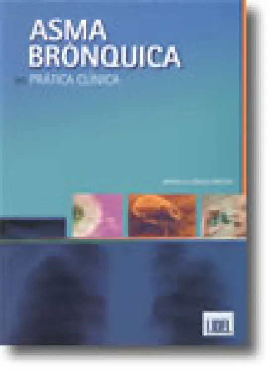 Asma Brônquica na Prática Clínica