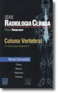 Coluna Vertebral - Os 100 Principais Diagnósticos