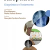 Escoliose Idiopática - Diagnóstico e Tratamento-Diagnóstico e Tratamento