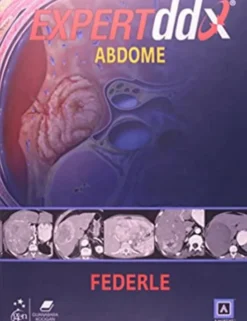 Expertddx - Abdome