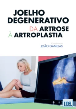 Joelho Degenerativo - da Artrose à Artroplastia