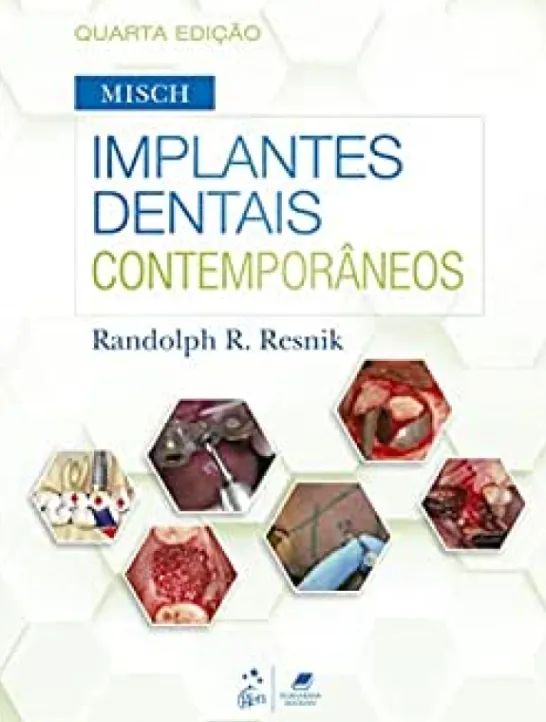 Misch - Implantes Dentais Contemporâneos