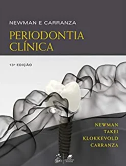Newman e Carranza - Periodontia Clínica