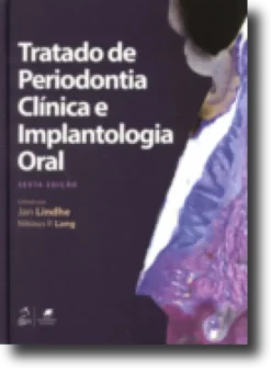 Tratado de Periodontia Clínica e Implantologia Oral