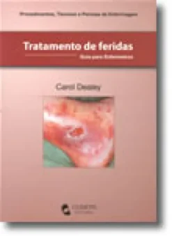 Tratamento de Feridas - Guia para Enfermeiros